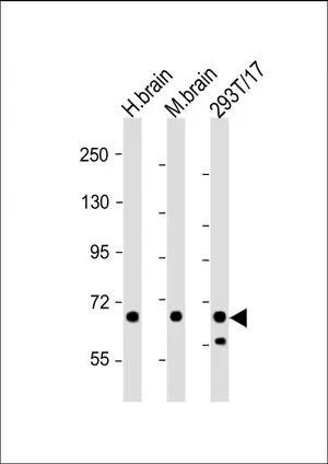WB analysis of various samples using GTX81012 GLS antibody, C-term. Lane 1: human brain lysate Lane 2: mouse brain lysate Lane 3: 293T/17 whole cell lysate Loading : 20 microg per lane Dilution : 1:2000