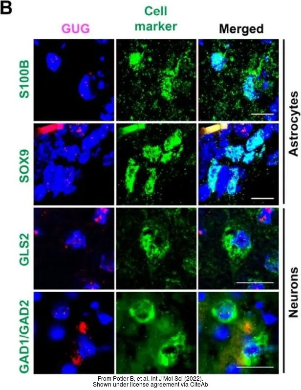 The data was published in the 2022 in Int J Mol Sci. PMID: 35054778