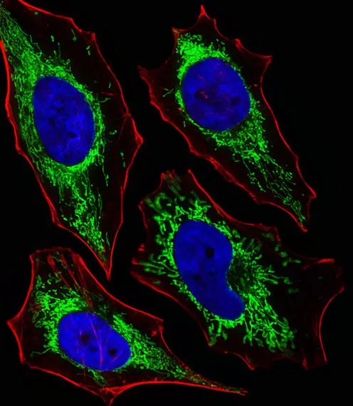 ICC/IF analysis of HeLa cells using GTX81012 GLS antibody, C-term. Green : GLS Red : Actin filament Blue : cell nucleus Dilution : 1:25