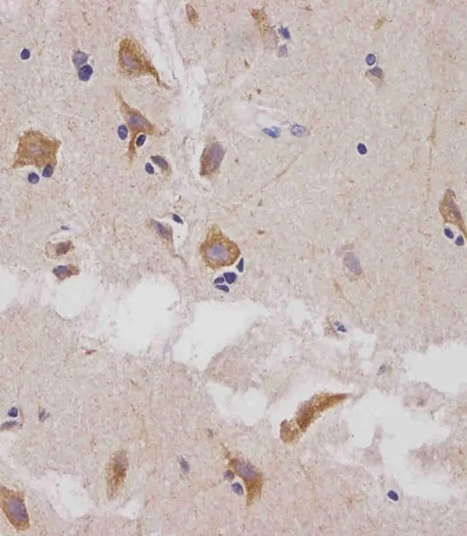 IHC-P analysis of human brain tissue using GTX81012 GLS antibody, C-term. Antigen retrieval : heat-induced antigen retrieval with a citrate buffer (pH6) Dilution : 1:25
