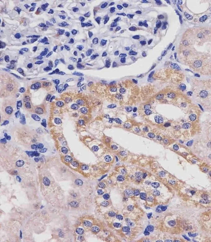 IHC-P analysis of human kidney tissue using GTX81012 GLS antibody, C-term. Antigen retrieval : heat-induced antigen retrieval with a citrate buffer (pH6) Dilution : 1:25