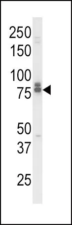 WB analysis of K562 cell lysate (35ug/lane) using GTX81019 IL18 Receptor beta antibody, N-term.