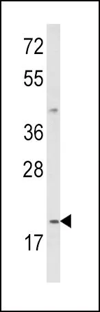 WB analysis of MDA-MB231 cell lysate (35ug/lane) using GTX81020 IL12A / IL12 p35 antibody, C-term.