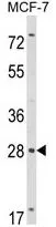 WB analysis of MCF-7 cell lysate (35ug/lane) using GTX81024 RASL11B antibody, N-term.