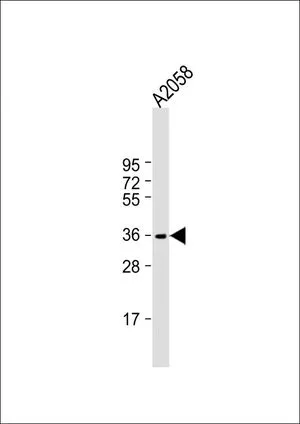 WB analysis of A2058 whole cell lysate using GTX81028 IGH antibody, C-term. Loading : 20 microg per lane Dilution : 1:1000