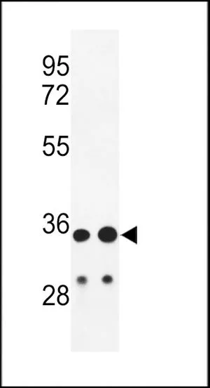 WB analysis of HL-60 and A2058 cell lysate (35ug/lane) using GTX81028 IGH antibody, C-term.