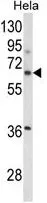 WB analysis of HeLa cell lysate (35ug/lane) using GTX81030 ITGBL1 antibody, Internal.