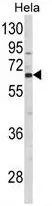 WB analysis of HeLa cell lysate (35ug/lane) using GTX81032 CTPS2 antibody, N-term.