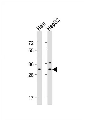 WB analysis of various samples using GTX81033 CTHRC1 antibody, N-term. Lane 1: HeLa whole cell lysate Lane 2: HepG2 whole cell lysate Loading : 20 microg per lane Dilution : 1:16000