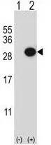 WB analysis of 293 cell lysate (2 ug/lane) either nontransfected (Lane 1) or transiently transfected with the CTHRC1(Lane 2) using GTX81033 CTHRC1 antibody, N-term.