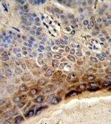 IHC-P analysis of human skin tissue using GTX81033 CTHRC1 antibody, N-term.