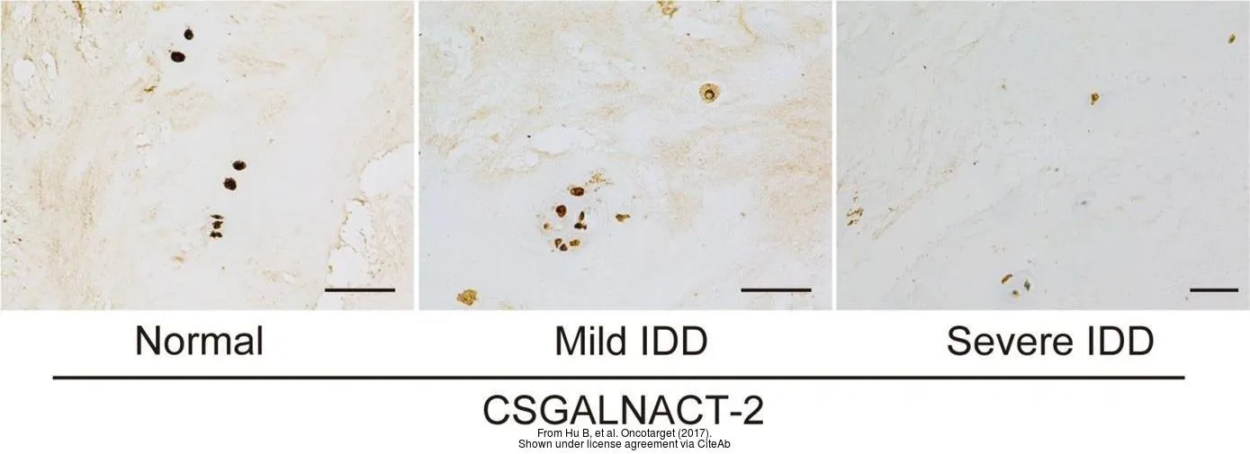 The data was published in the journal Oncotarget in 2017. PMID: 28514734