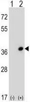WB analysis of 293 cell lysate (2 ug/lane) either nontransfected (Lane 1) or transiently transfected with the CDC42EP3(Lane 2) using GTX81035 CDC42EP3 antibody, N-term.