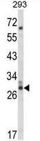 WB analysis of 293 cell lysate (35ug/lane) using GTX81035 CDC42EP3 antibody, N-term.