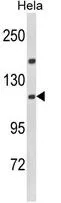 WB analysis of HeLa cell lysate (35ug/lane) using GTX81038 IPO11 antibody, N-term.