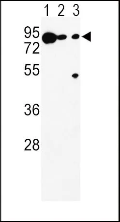 WB analysis of K562(lane 1), A375(lane 2), Ramos(lane 3) cell lysate (35ug/lane) using GTX81039 DCT antibody, N-term.