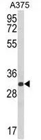 WB analysis of A375 cell lysate (35ug/lane) using GTX81043 DERA antibody, N-term.