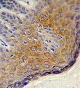 IHC-P analysis of human skin tissue using GTX81043 DERA antibody, N-term.