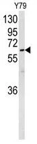 WB analysis of Y79 cell lysate (35ug/lane) using GTX81057 NEURL antibody, Internal.
