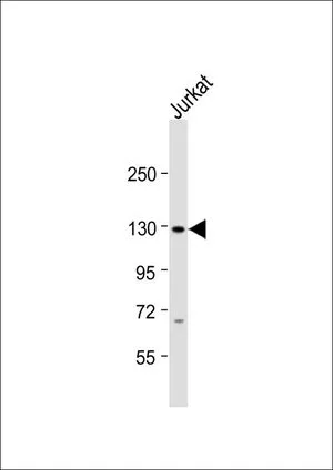 WB analysis of Jurkat whole cell lysate using GTX81061 SREBP1 antibody, Internal. Loading : 20 microg per lane Dilution : 1:1000