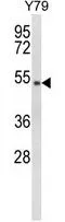WB analysis of Y79 cell lysate (35ug/lane) using GTX81063 GTF2H4 antibody, Internal.