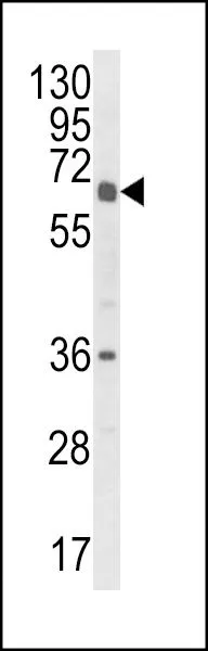 WB analysis of HL-60 cell lysate (35ug/lane) using GTX81067 CYP2C18 antibody, C-term.