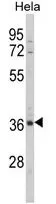 WB analysis of HeLa cell lysate (35ug/lane) using GTX81076 MDFIC antibody, N-term.
