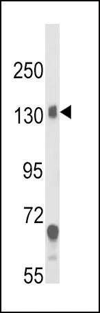 WB analysis of mouse brain tissue lysate (35ug/lane) using GTX81084 CACNA2D1 antibody, N-term.