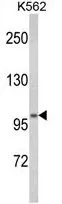 WB analysis of K562 cell lysate (35ug/lane) using GTX81091 ATP12A antibody, Internal.