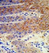 IHC-P analysis of human skin tissue using GTX81091 ATP12A antibody, Internal.
