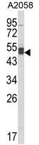 WB analysis of A2058 cell lysate (35ug/lane) using GTX81092 AGPAT3 antibody, Internal.