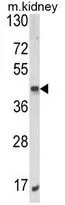 WB analysis of mouse kidney tissue lysate (35ug/lane) using GTX81095 ALKBH3 antibody, C-term.