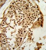 IHC-P analysis of human testis tissue using GTX81098 PARD3 antibody, C-term.