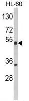 WB analysis of HL-60 cell lysate (35ug/lane) using GTX81102 PXR antibody, Internal.