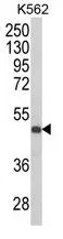 WB analysis of K562 cell lysate (35ug/lane) using GTX81103 KIR3DS1 antibody, C-term.