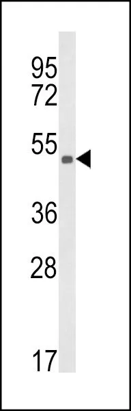 WB analysis of CEM cell lysate (35ug/lane) using GTX81111 KMO antibody, Internal.