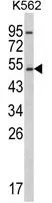 WB analysis of K562 cell lysate (35ug/lane) using GTX81120 CYP2E1 antibody, C-term.