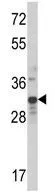 WB analysis of MDA-MB231 cell lysate (35ug/lane) using GTX81125 MLX antibody, Internal.