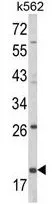 WB analysis of K562 cell lysate (35ug/lane) using GTX81129 CD94 antibody, N-term.