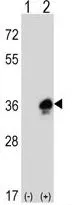 WB analysis of 293 cell lysate (2 ug/lane) either nontransfected (Lane 1) or transiently transfected with the MPZ (Lane 2) using GTX81135 MPZ antibody, C-term.
