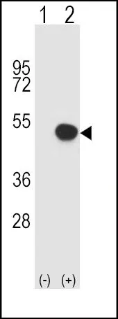 WB analysis of 293 cell lysate (2 ug/lane) either nontransfected (Lane 1) or transiently transfected with the HLA-B (Lane 2) using GTX81138 HLA-B antibody, N-term.