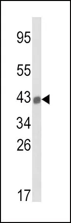WB analysis of A2058 cell lysate (35ug/lane) using GTX81138 HLA-B antibody, N-term.