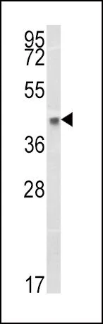 WB analysis of A375 cell lysate (35ug/lane) using GTX81138 HLA-B antibody, N-term.