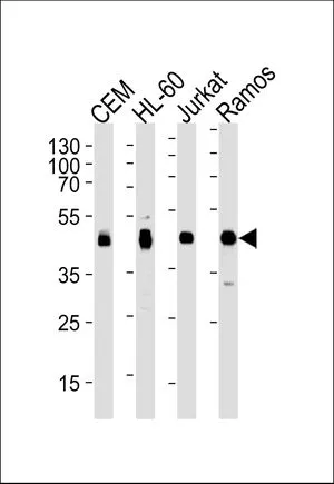 WB analysis of CEM, HL-60, Jurkat, Ramos cell using GTX81138 HLA-B antibody, N-term. Loading : 35ug per lane Dilution : 1:1000