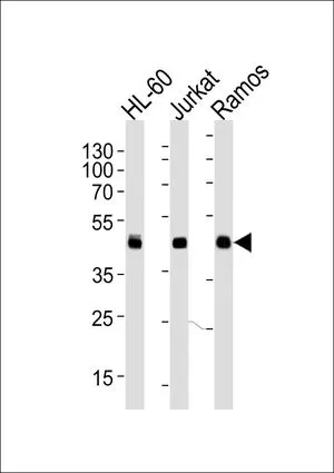 WB analysis of HL-60, Jurkat, Ramos cell using GTX81138 HLA-B antibody, N-term. Loading : 35ug per lane Dilution : 1:1000