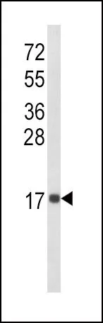 WB analysis of MDA-MB468 cell lysate (35ug/lane) using GTX81140 CXCL8 / IL8 antibody, C-term.