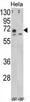 WB analysis of HeLa cell lysate (35ug/lane) using GTX81141 LMOD1 antibody, Internal.