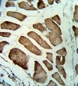 IHC-P analysis of human skeletal muscle using GTX81141 LMOD1 antibody, Internal.