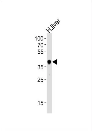 WB analysis of human liver tissue lysate (35ug/lane) using GTX81144 HAO1 antibody, Internal. Loading : 35ug Dilution : 1:1000