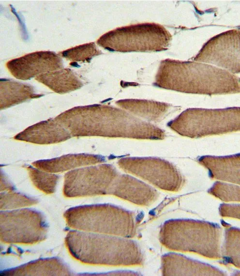 IHC-P analysis of human skeletal muscle using GTX81146 WNT5B antibody, Internal.